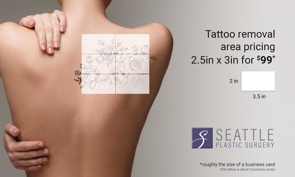 Removing Unwanted Tattoos  Seattle Skin  Laser