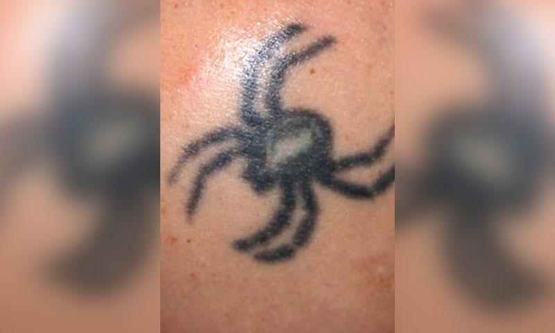 Easiest Tattoo Colors to Remove - Tattoo Removal Seattle